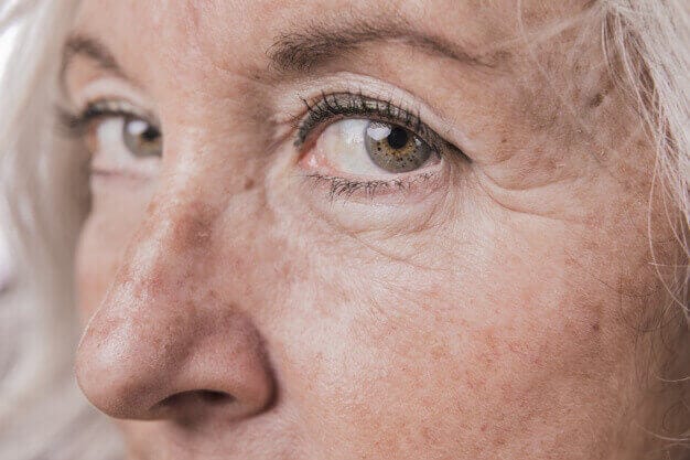 Doença de Alzheimer: como agir?